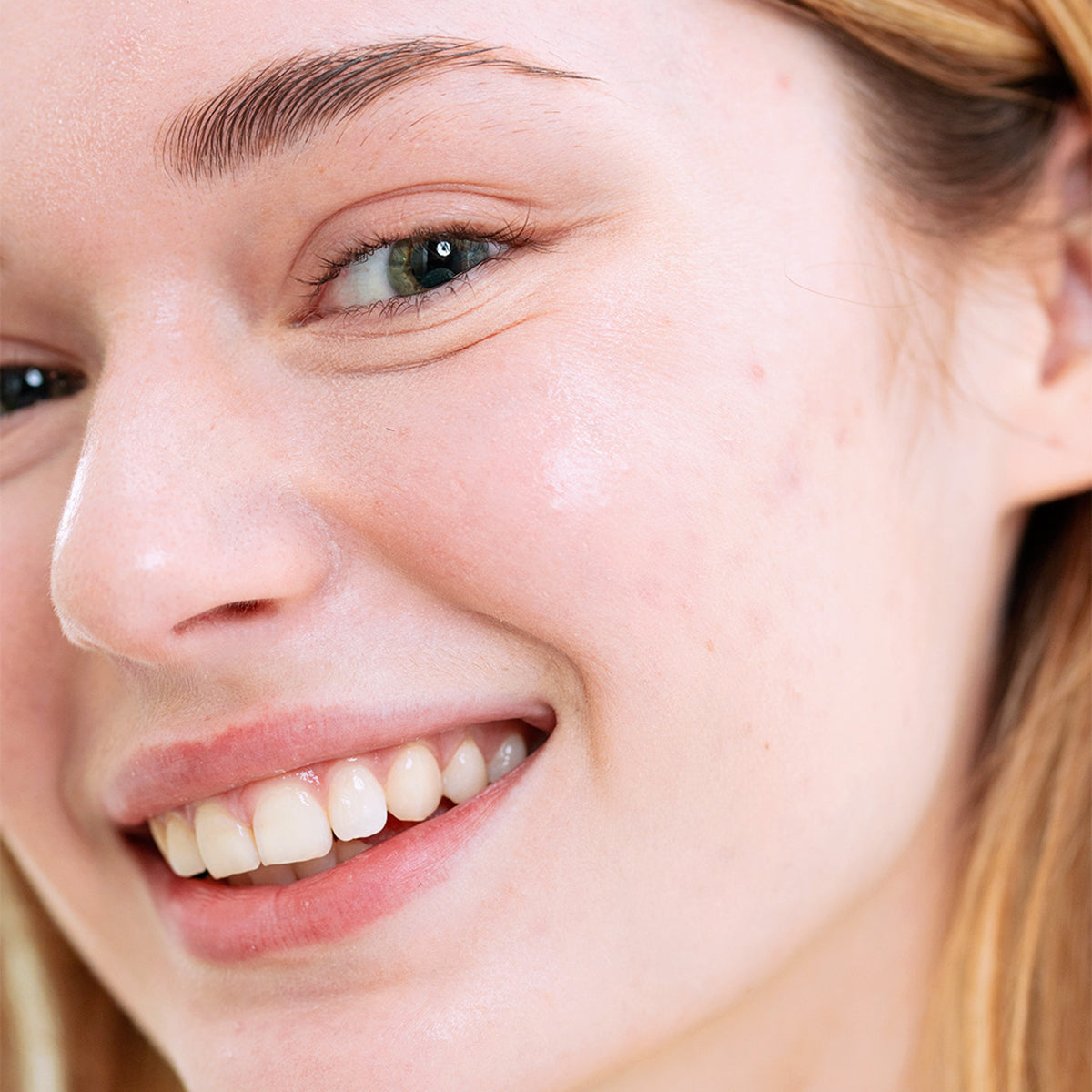 Close-up of a smiling woman with clear, healthy skin after using SEBIACLEAR Creme SPF50+ for sun protection.