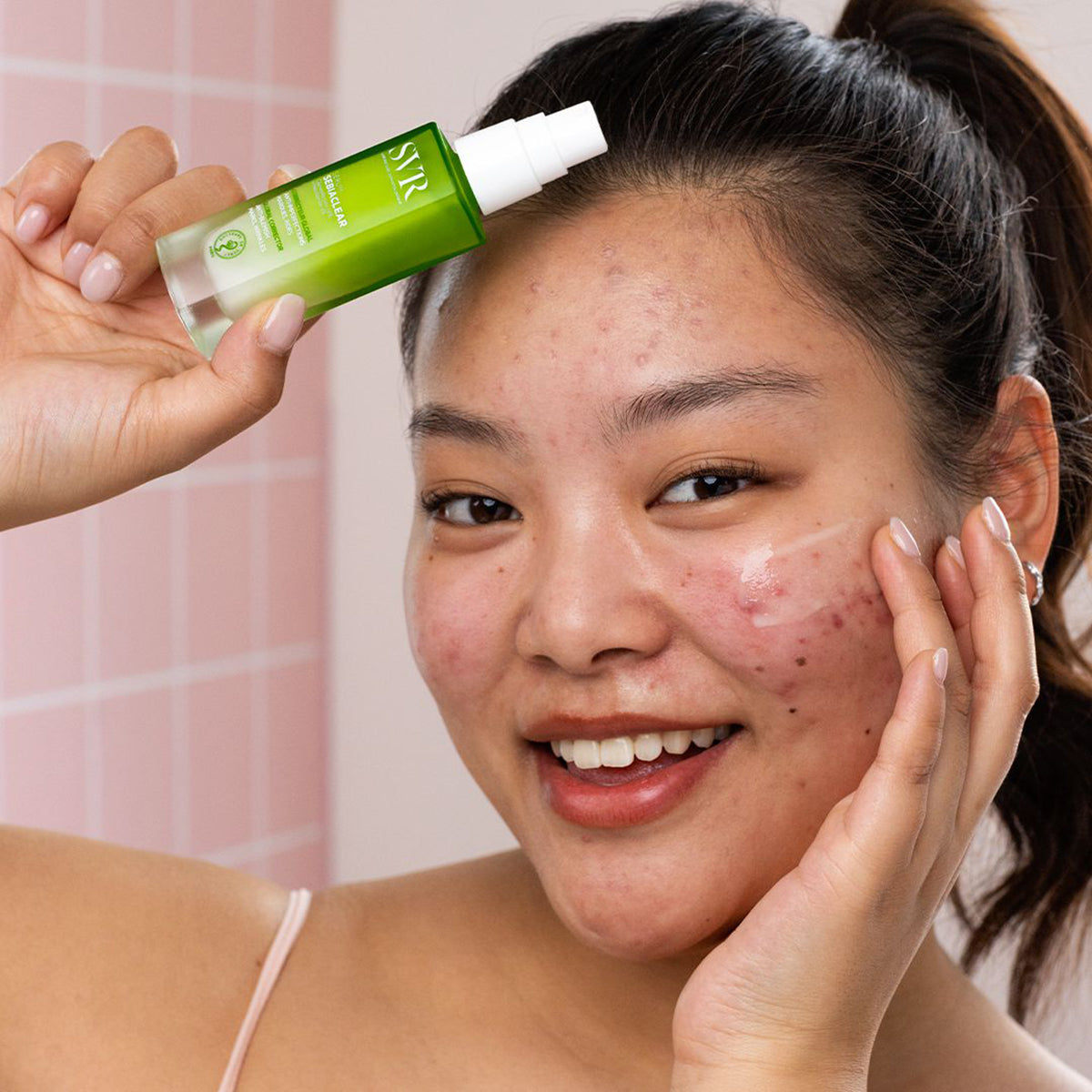 Smiling woman holding a green SVR Sebiaclear serum bottle while applying clear product to her acne-prone skin.