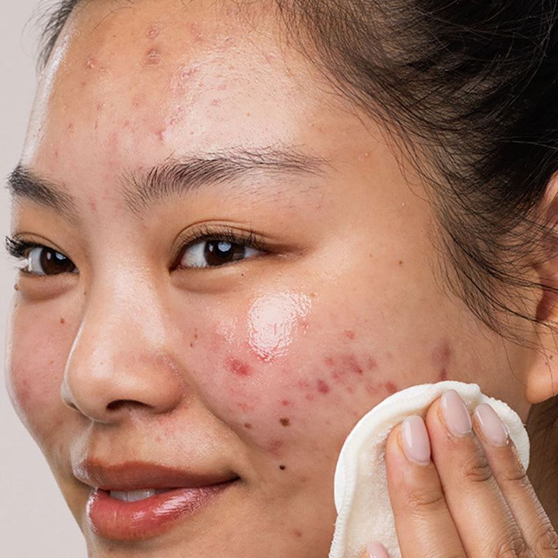 SEBIACLEAR Eau Micellaire